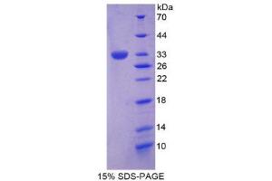 Image no. 1 for Protein tyrosine Phosphatase, Receptor Type, H (PTPRH) (AA 844-1096) protein (His tag,T7 tag) (ABIN2126542)