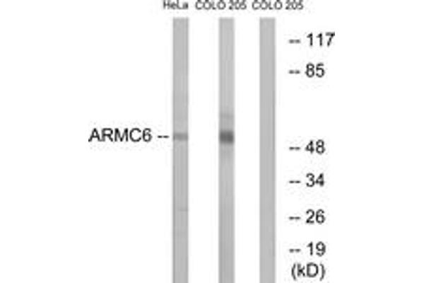 anti-Armadillo Repeat Containing 6 (ARMC6) (AA 431-480) antibody