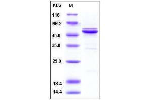 Image no. 1 for Mitogen-Activated Protein Kinase 9 (MAPK9) (AA 1-424), (full length) protein (His tag) (ABIN2003337)