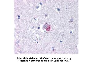 Image no. 2 for anti-Mitofusin 1 (MFN1) (AA 348-579) antibody (ABIN2852234)
