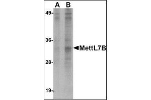 Image no. 1 for anti-Methyltransferase Like 7B (METTL7B) (N-Term) antibody (ABIN500278)