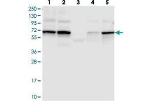 Image no. 2 for anti-Trichoplein, Keratin Filament Binding (TCHP) antibody (ABIN5589271)