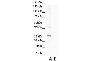Image no. 5 for anti-Aspartate beta-Hydroxylase (ASPH) (N-Term) antibody (ABIN2784532)