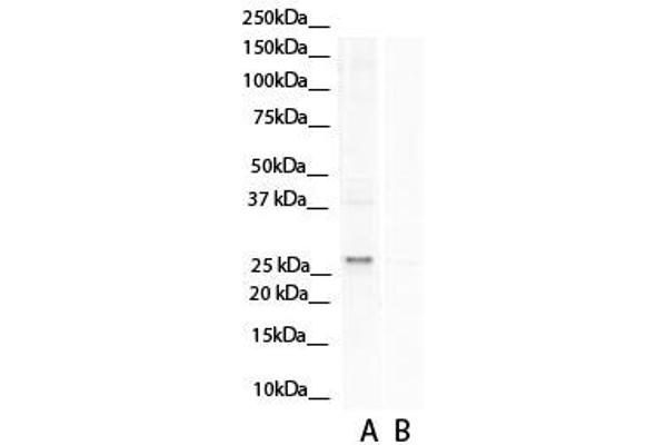 Aspartate beta Hydroxylase antibody  (N-Term)