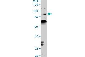Image no. 4 for anti-K(lysine) Acetyltransferase 2B (KAT2B) (AA 353-452) antibody (ABIN522304)