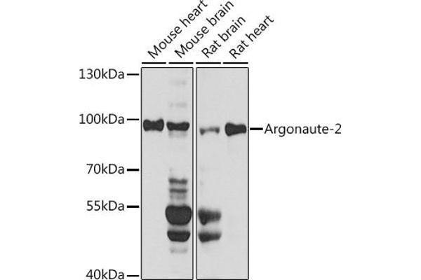 AGO2 抗体  (AA 1-100)
