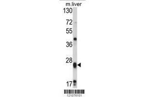 Image no. 2 for anti-Glutathione S-Transferase mu 1 (GSTM1) (AA 184-211), (C-Term) antibody (ABIN390883)