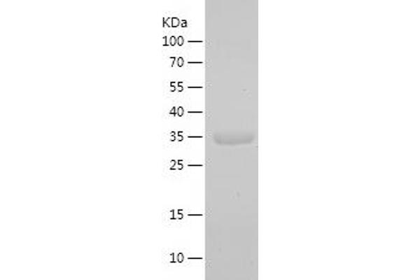LAP3 Protein (AA 252-368) (IF2DI tag)
