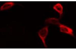 Image no. 1 for anti-Eukaryotic Translation Initiation Factor 4B (EIF4B) (pSer422) antibody (ABIN6255321)