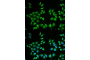 Image no. 2 for anti-Eukaryotic Translation Initiation Factor 6 (EIF6) antibody (ABIN1872511)