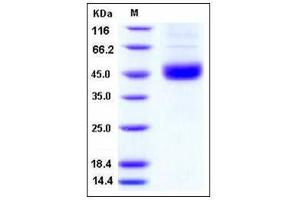 Image no. 1 for SET and MYND Domain Containing 2a (SMYD2A) (AA 1-433), (full length) protein (His tag) (ABIN2003971)