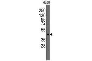 Image no. 1 for anti-LIM Homeobox Transcription Factor 1, alpha (LMX1A) (Center) antibody (ABIN356908)