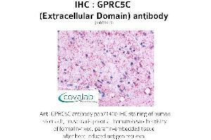 Image no. 1 for anti-G Protein-Coupled Receptor, Family C, Group 5, Member C (GPRC5C) (3rd Extracellular Domain) antibody (ABIN1735217)