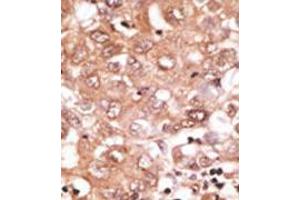 Image no. 2 for anti-Growth Differentiation Factor 2 (GDF2) (N-Term) antibody (ABIN357458)
