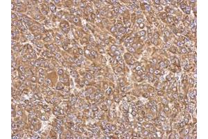 IHC-P Image Immunohistochemical analysis of paraffin-embedded HBL435 xenograft, using FACL4, antibody at 1:500 dilution.