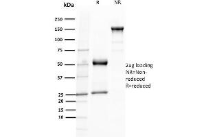Image no. 5 for anti-T-Cell Leukemia/lymphoma 1A (TCL1A) (AA 2-109) antibody (ABIN6940949)