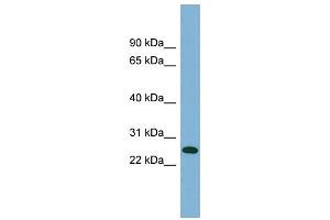WB Suggested Anti-ITGB1BP3 Antibody Titration:  0.