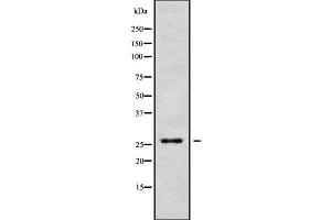 Image no. 1 for anti-Paired Related Homeobox 2 (PRRX2) antibody (ABIN6264451)
