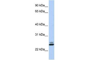 Image no. 1 for anti-JAZF Zinc Finger 1 (JAZF1) (N-Term) antibody (ABIN2775141)