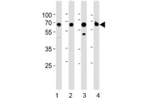 Image no. 1 for anti-Acyl-CoA Synthetase Medium-Chain Family Member 5 (ACSM5) (AA 562-596) antibody (ABIN5647744)