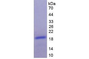 Image no. 1 for Brain Natriuretic Peptide (BNP) (AA 77-121) protein (His tag,SUMO Tag) (ABIN6236664)