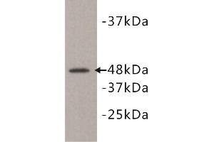 Image no. 1 for anti-Kinase D-Interacting Substrate, 220kDa (KIDINS220) antibody (ABIN1854930)