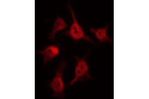 Image no. 4 for anti-BCL6 Co-Repressor (BCOR) antibody (ABIN6257962)