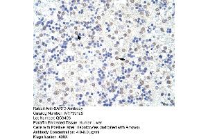 Image no. 2 for anti-Squamous Cell Carcinoma Antigen Recognized By T Cells 3 (SART3) (N-Term) antibody (ABIN2780944)