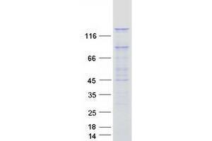 Image no. 1 for PAN2 Poly(A) Specific Ribonuclease Subunit Homolog (PAN2) (Transcript Variant 1) protein (Myc-DYKDDDDK Tag) (ABIN2735134)