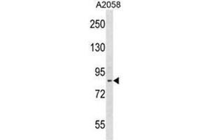 Image no. 1 for anti-ADAM Metallopeptidase Domain 23 (Adam23) (AA 802-831), (C-Term) antibody (ABIN950268)