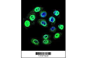 Image no. 3 for anti-SMAD Family Member 4 (SMAD4) (pThr277) antibody (ABIN389658)