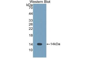Image no. 1 for anti-Cystatin-Like 1 (CSTL1) (AA 21-141) antibody (ABIN2897938)
