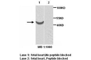 Image no. 1 for anti-ARP1 Actin-Related Protein 1 Homolog B, Centractin beta (ACTR1B) antibody (ABIN6583484)