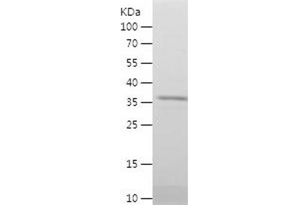 SHMT2 Protein (AA 24-147) (His-IF2DI Tag)