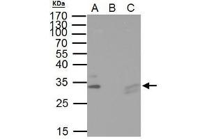 Image no. 4 for anti-HIV-1 Tat Interactive Protein 2, 30kDa (HTATIP2) (full length) antibody (ABIN2857073)