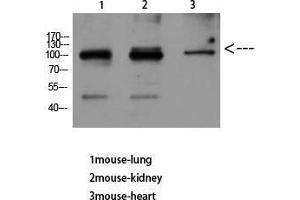 Western Blot (WB) analysis of Mouse Lung Mouse Kidney Mouse Heart using VE-Cadherin Polyclonal Antibody diluted at 1:500.