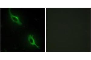 Image no. 2 for anti-Creatine Kinase, Mitochondrial 2 (Sarcomeric) (CKMT2) (AA 231-280) antibody (ABIN1533635)