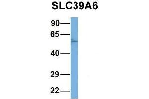 Image no. 6 for anti-Solute Carrier Family 39 (Zinc Transporter), Member 6 (SLC39A6) (Middle Region) antibody (ABIN2781630)