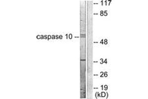Image no. 1 for anti-Caspase 10, Apoptosis-Related Cysteine Peptidase (CASP10) (AA 430-479) antibody (ABIN1533218)
