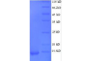 Chemokine (C-X-C Motif) Ligand 1 (Melanoma Growth Stimulating Activity, Alpha) (CXCL1) (AA 35-107), (full length) protein (His tag)