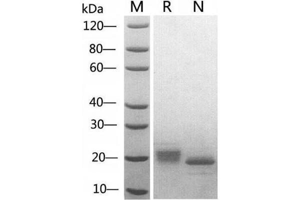 KIT Ligand Protein (KITLG)