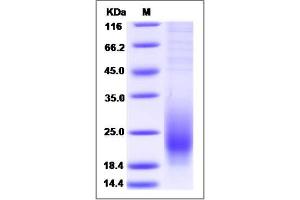 Image no. 1 for CD53 (CD53) (AA 107-181) protein (His tag) (ABIN2008235)