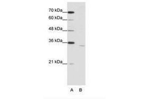 Image no. 1 for anti-Cytoplasmic Polyadenylation Element Binding Protein 2 (CPEB2) (AA 473-522) antibody (ABIN203062)