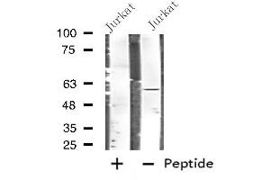 Image no. 1 for anti-Fibrinogen beta Chain (FGB) (C-Term) antibody (ABIN6258456)