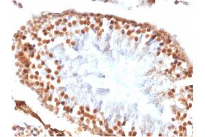 Image no. 3 for anti-Wilms Tumor 1 (WT1) antibody (ABIN6940905)