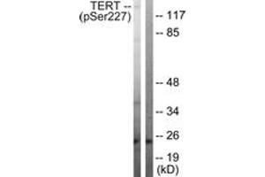 Western Blotting (WB) image for anti-Telomerase Reverse Transcriptase (TERT) (AA 196-245), (pSer227) antibody (ABIN1531729)