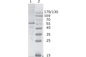 Image no. 1 for anti-Human Immunodeficiency Virus 1 Capsid (HIV-1 p24) (AA 1-104), (N-Term) antibody (ABIN400479)