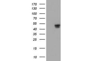 Image no. 2 for anti-Adipocyte Plasma Membrane Associated Protein (APMAP) antibody (ABIN2716266)