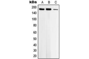 Image no. 3 for anti-Topoisomerase (DNA) II beta 180kDa (TOP2B) (N-Term) antibody (ABIN2707765)