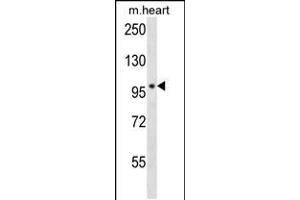 Western blot analysis in mouse heart tissue lysates (35ug/lane).